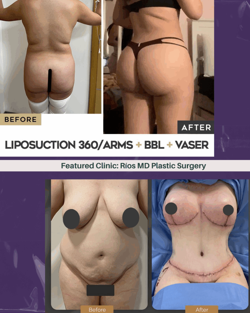 Dr. Andrei Rios Tijuana before after