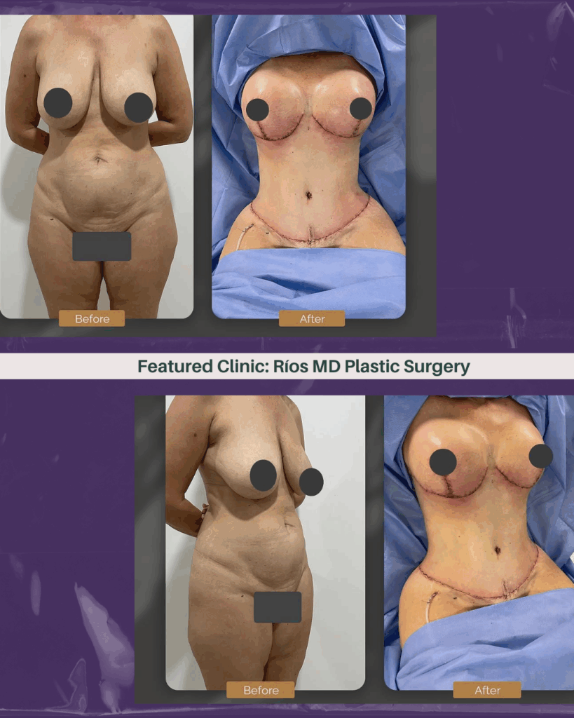 Dr. Andrei Rios Tijuana before after