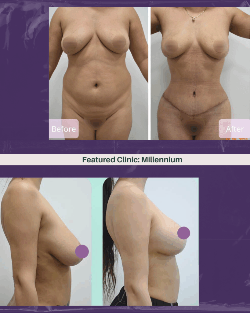 Millennium Clinic Tijuana plastic surgery