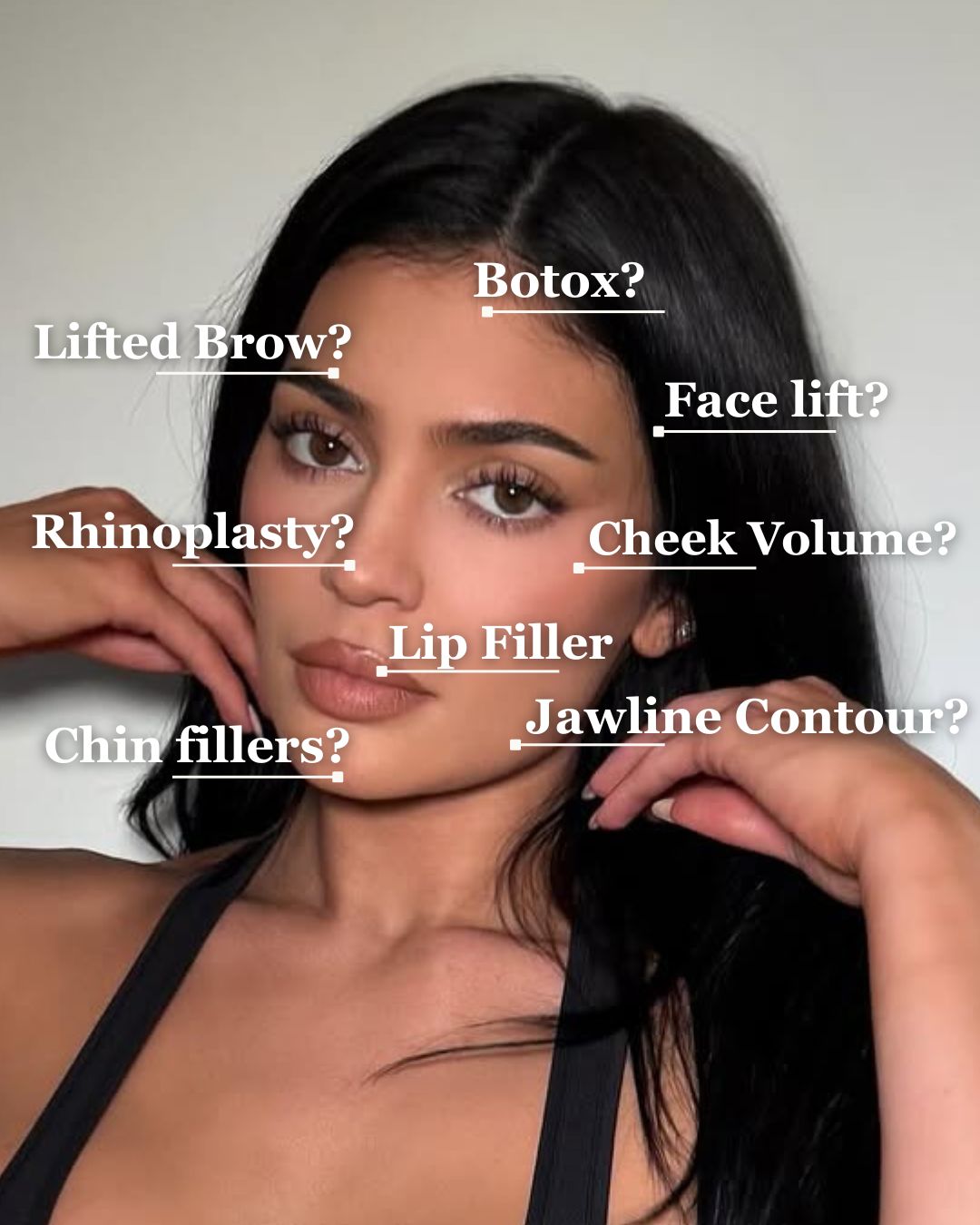 kyile-jenner-plastic-surgery-cost