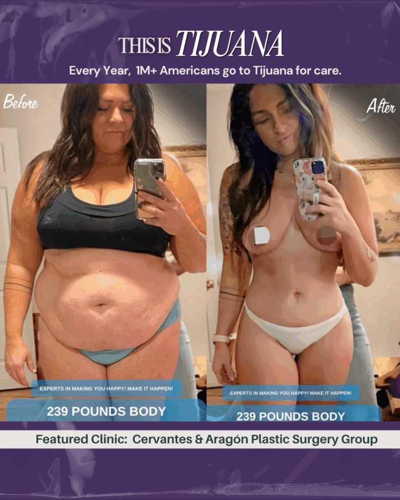 Cervantes & Aragón Plastic Surgery Tijuana
