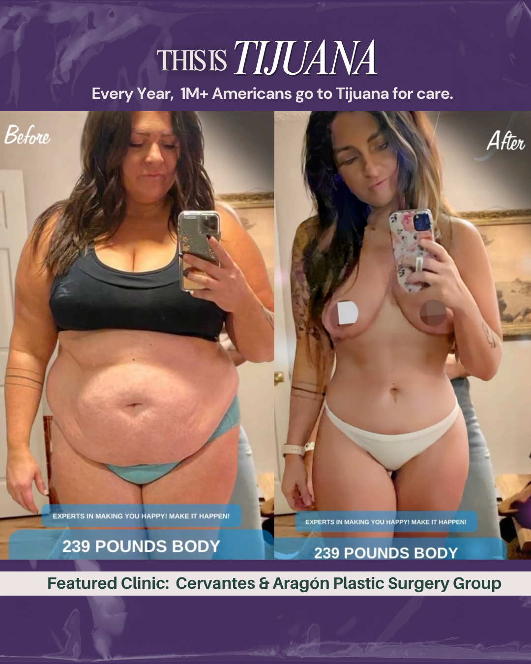 Cervantes & Aragón Plastic Surgery Tijuana