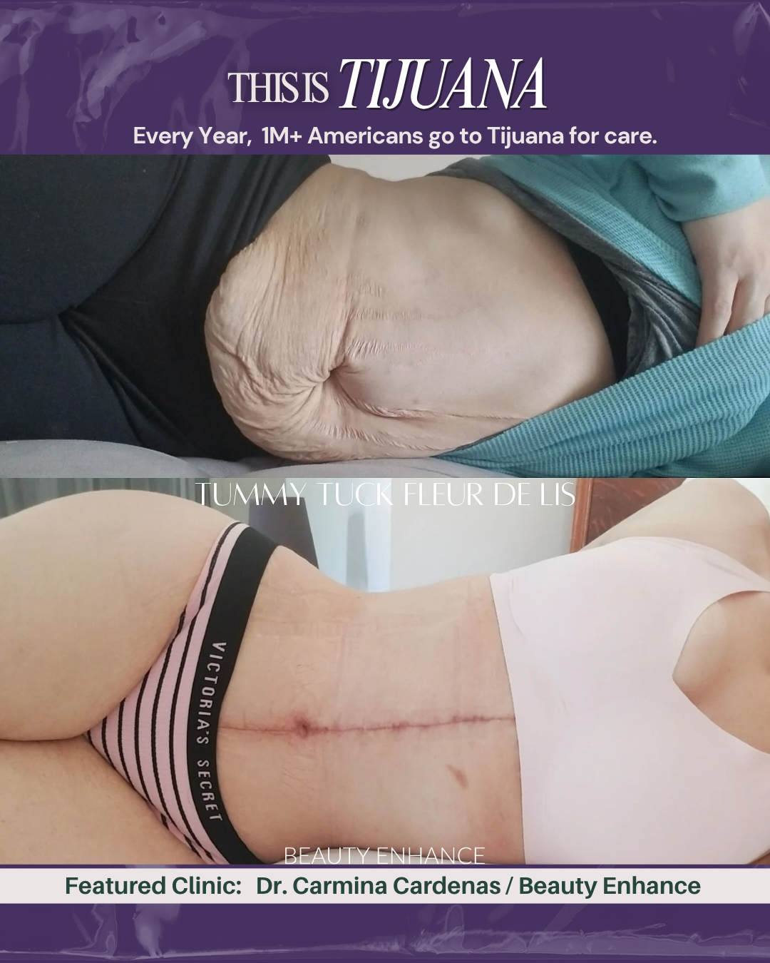 Dr. Carmina Cardenas Tijuana