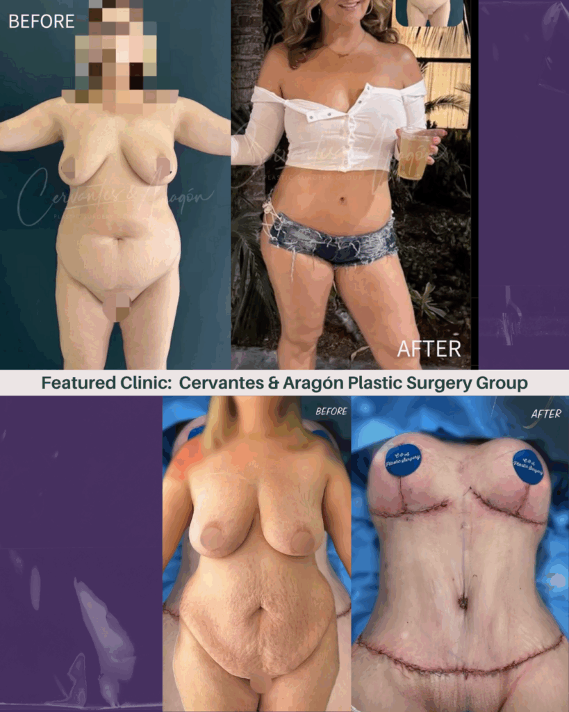 Cervantes & Aragón Plastic Surgery Group transformation