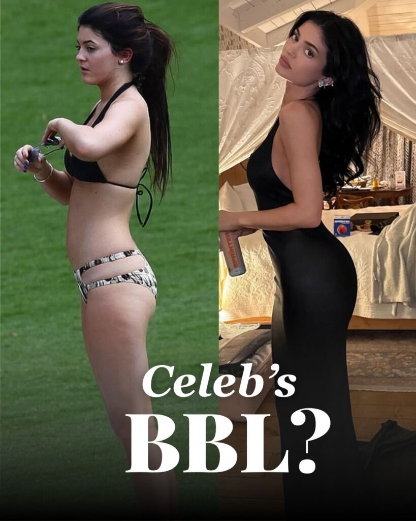 celebrities BBL before after