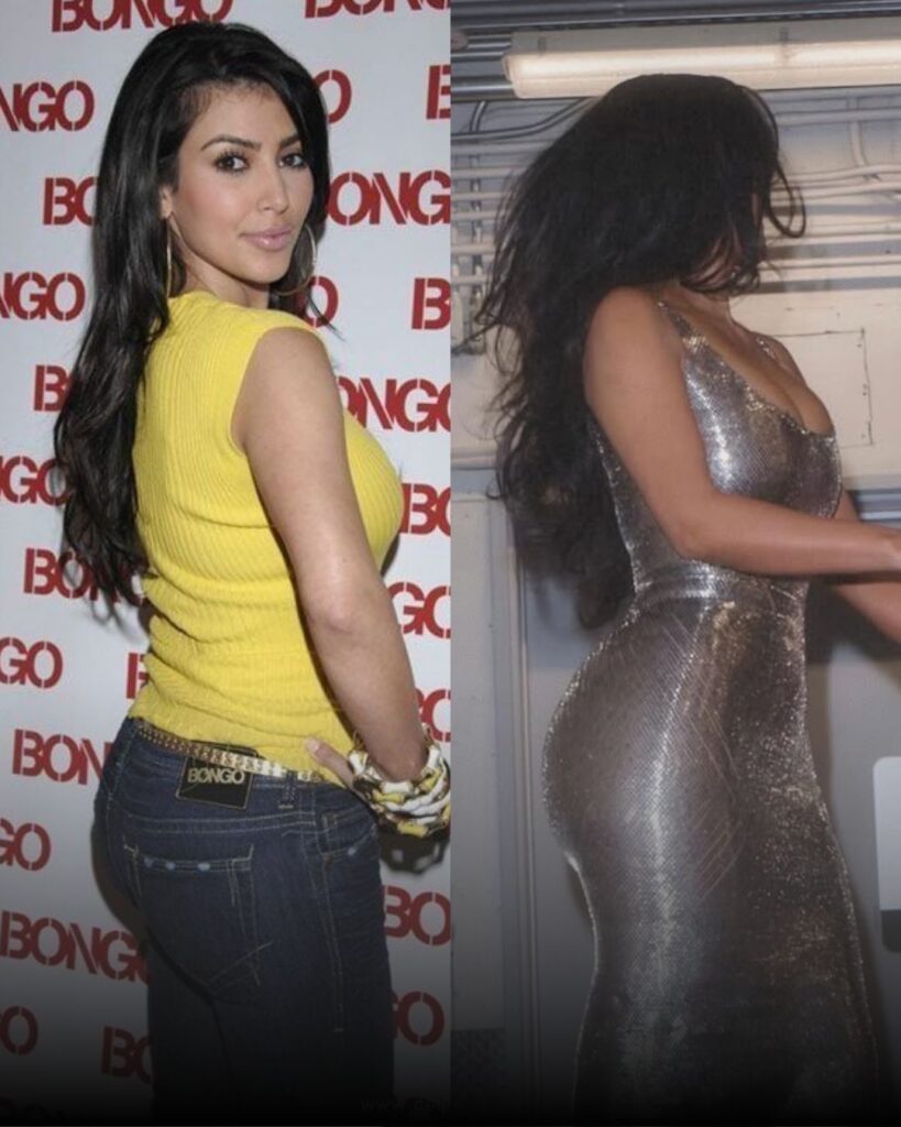 celebrities BBL before after