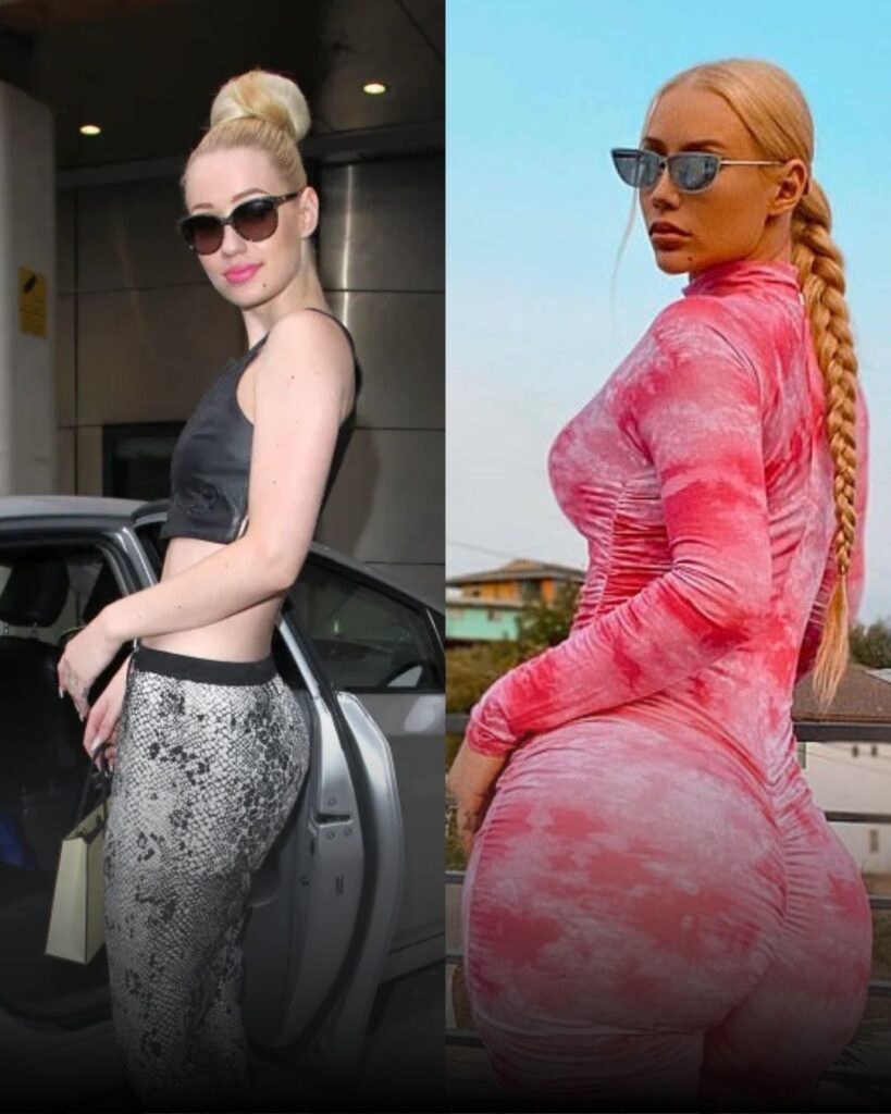 celebrities BBL before after