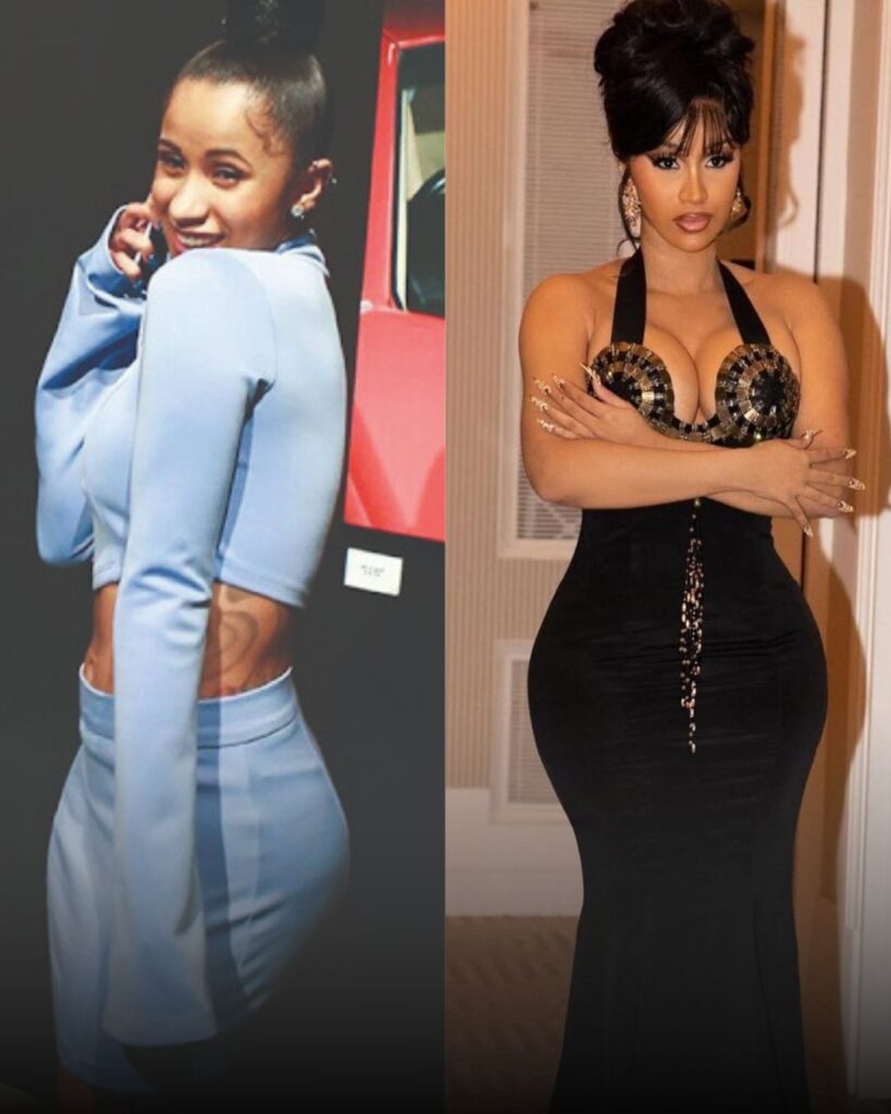 celebrities BBL before after